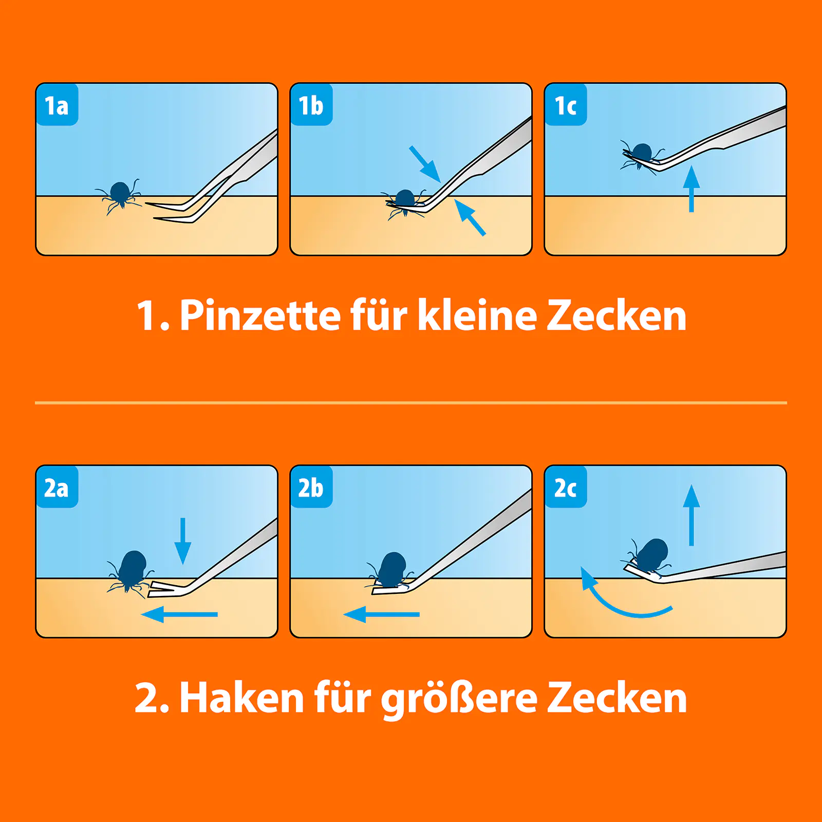 ARDAP Zeckenzange Edelstahl für Tiere
